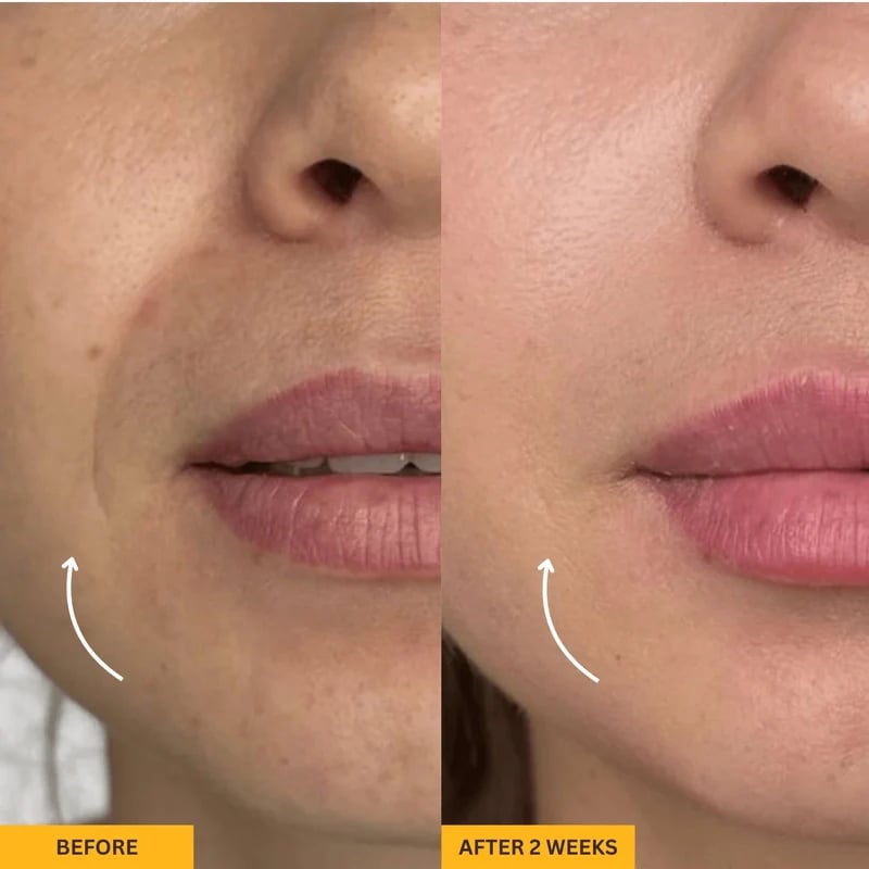 🔥#1 Bestseller - Sconto del 49%丨Gua Sha Brush - Sculpt Your Face Effortlessly